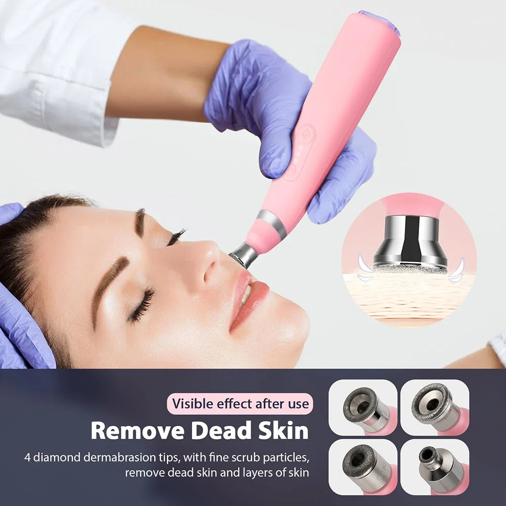 "Portable Diamond Microdermabrasion Vacuum- Blackhead Remover"